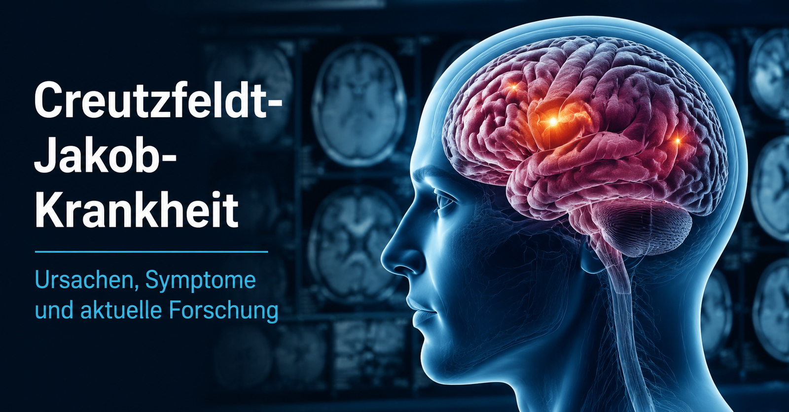 Creutzfeldt-Jakob-Krankheit: Ursachen, Symptome, Verlauf und aktuelles medizinisches Wissen über die seltene Hirnerkrankung